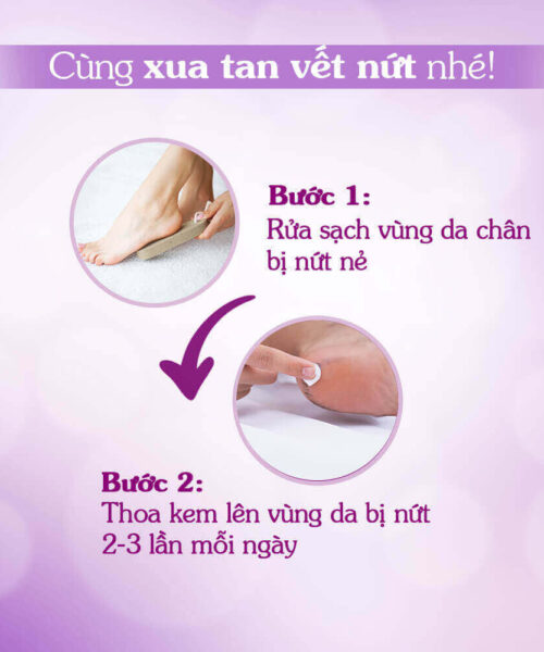 hướng dẫn sử dụng kem nứt gót Oriss