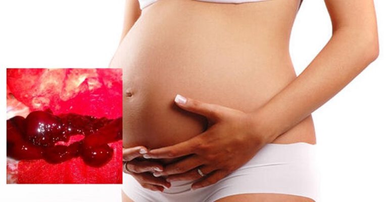 Nếu chảy nhiều máu và xuất hiện máu đông khi mang thai thì bạn nên tìm đến bác sĩ - có thai thì có kinh nguyệt không.